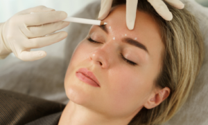 Botox Treatment